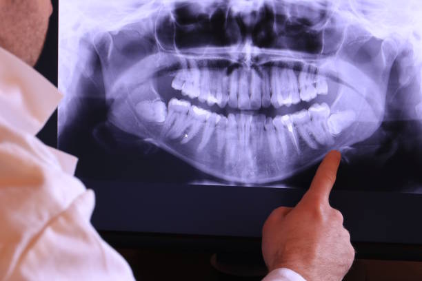 Best Holiday Emergency Dentist in Parker, FL