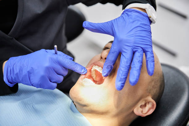 Best Emergency Dentist for Lost Fillings or Crowns in Parker, FL